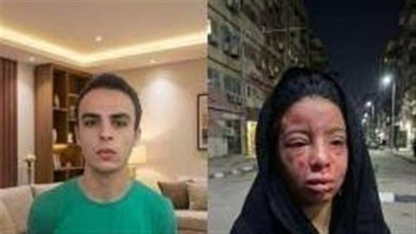 خشونت علیه کودکان؛ وقتی چشم یک دختر خاموش شد