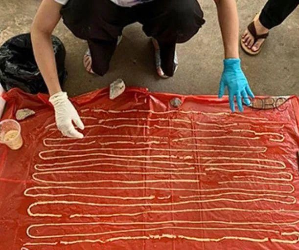 کرم ۱۸ متری تایلند چگونه در بدن مردی رشد کرد؟