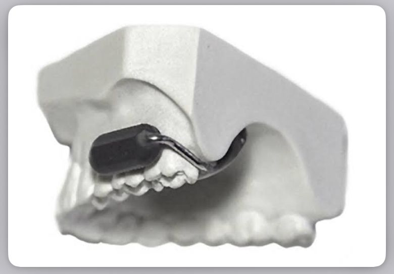 ردیاب دندان خامنهای ترور را لو داد؟